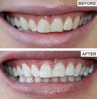 HiSmile V34 Teeth Whitening Serum